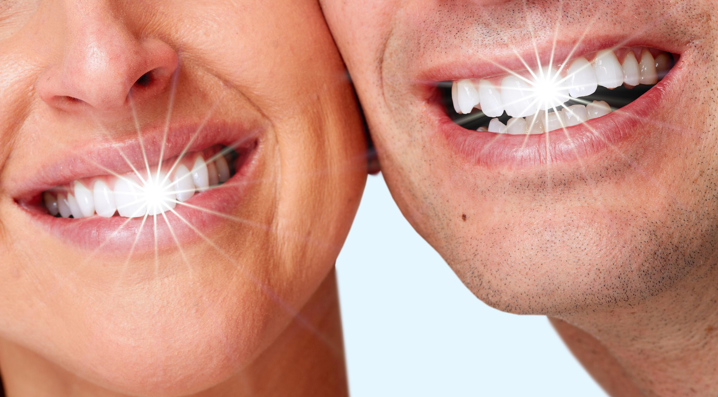 Teeth Whitening Tijuana